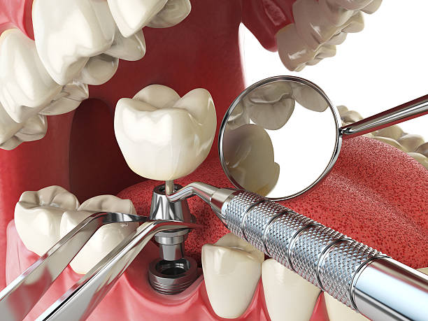 Best Urgent Dental Care for Toothache in White House, TN